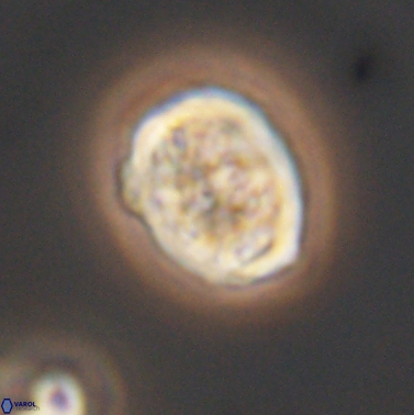 Calcicalathina erbae 11451