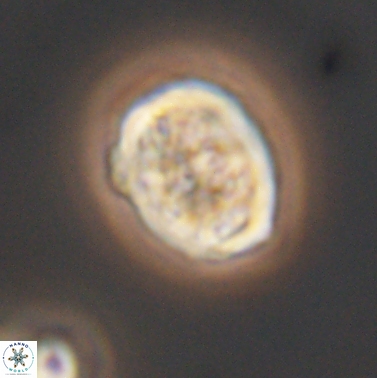Calcicalathina erbae 11451