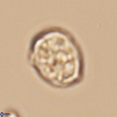 Calcicalathina erbae 11452