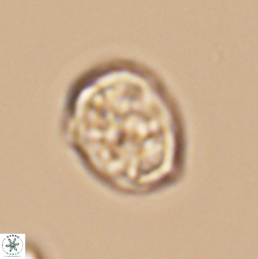 Calcicalathina erbae 11452