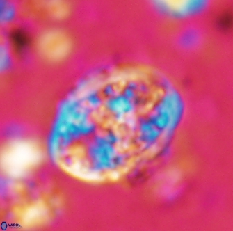 Calcicalathina erbae 1279