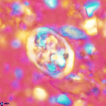 Calcicalathina clipeus 2138