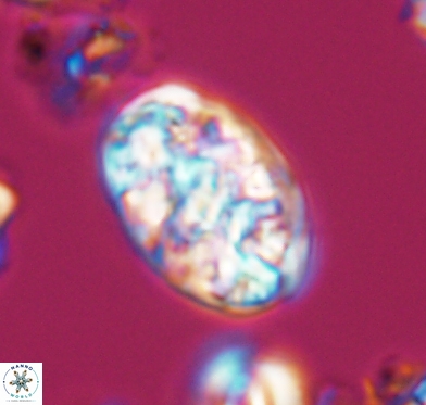 Calcicalathina oblongata 10587