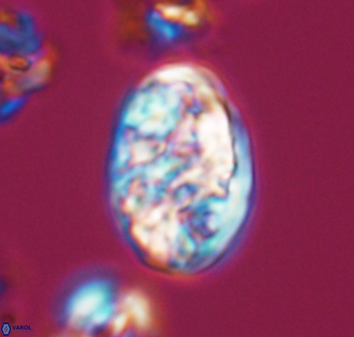 Calcicalathina oblongata 10589