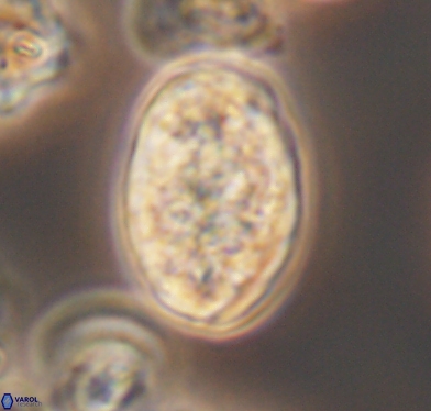 Calcicalathina oblongata 10593