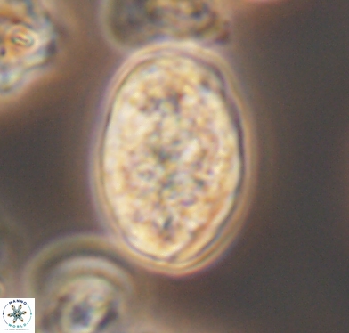 Calcicalathina oblongata 10593