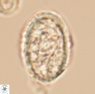 Calcicalathina oblongata 12467