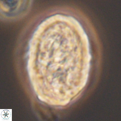 Calcicalathina oblongata 12468