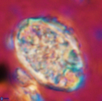 Calcicalathina oblongata 1290