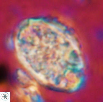 Calcicalathina oblongata 1290