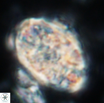 Calcicalathina oblongata 1291