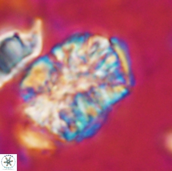 Calcicalathina oblongata 1299