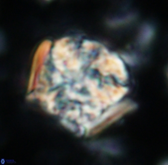 Calcicalathina oblongata 1310