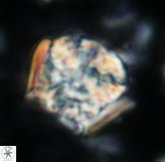 Calcicalathina oblongata 1310