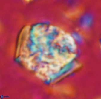 Calcicalathina oblongata 1311