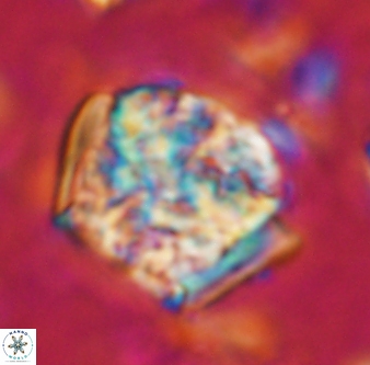 Calcicalathina oblongata 1311