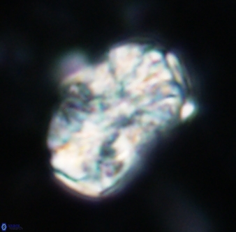 Calcicalathina oblongata 1322