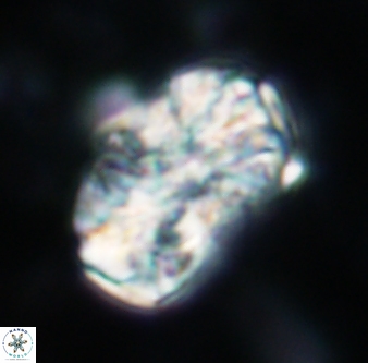 Calcicalathina oblongata 1322
