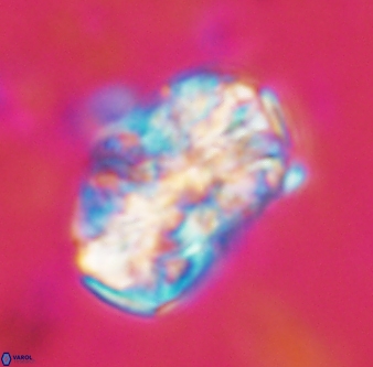 Calcicalathina oblongata 1323