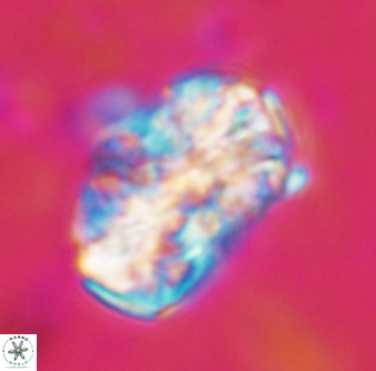 Calcicalathina oblongata 1323