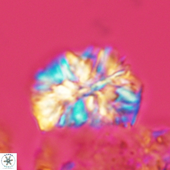Calcicalathina oblongata 3505