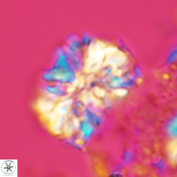 Calcicalathina oblongata 3506