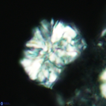 Calcicalathina oblongata 3507