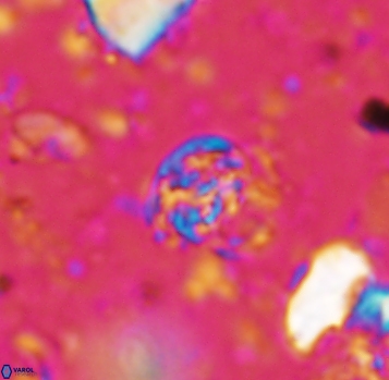 Calcicalathina pseudoalta 1052