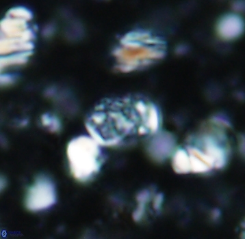 Calcicalathina pseudoalta 1066