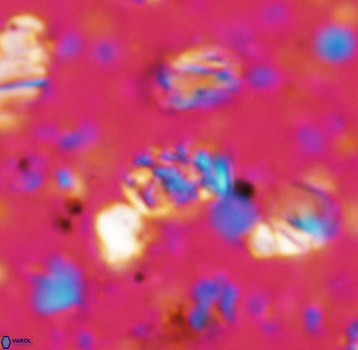 Calcicalathina pseudoalta 1067