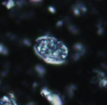 Calcicalathina pseudoalta 1079