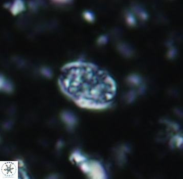 Calcicalathina pseudoalta 1079