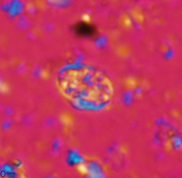 Calcicalathina pseudoalta 1080