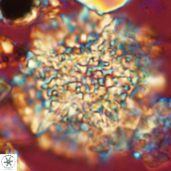 Calcidinellum operosum VR 06085