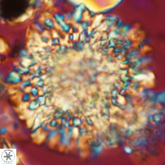 Calcidinellum operosum VR 06089