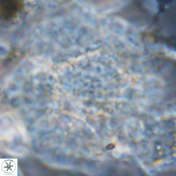 Calcidinellum operosum VR 06096