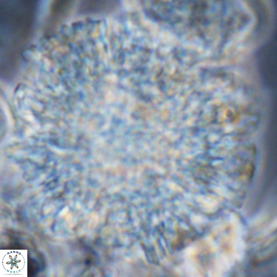 Calcidinellum operosum VR 06098