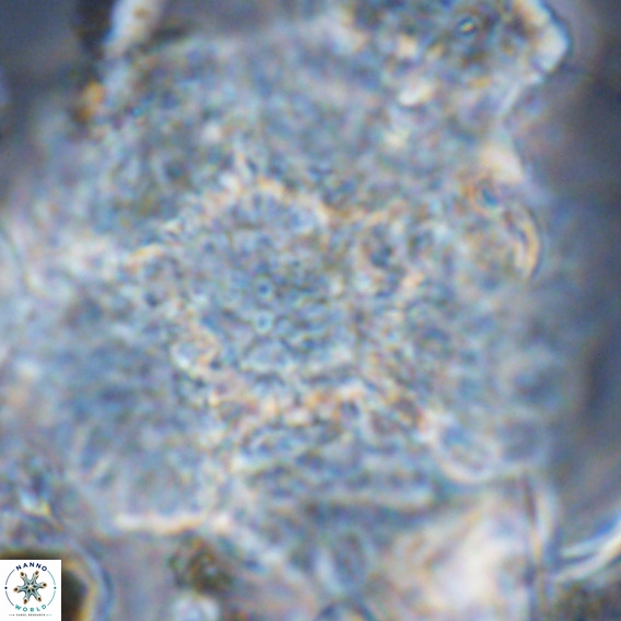 Calcidinellum operosum VR 06099
