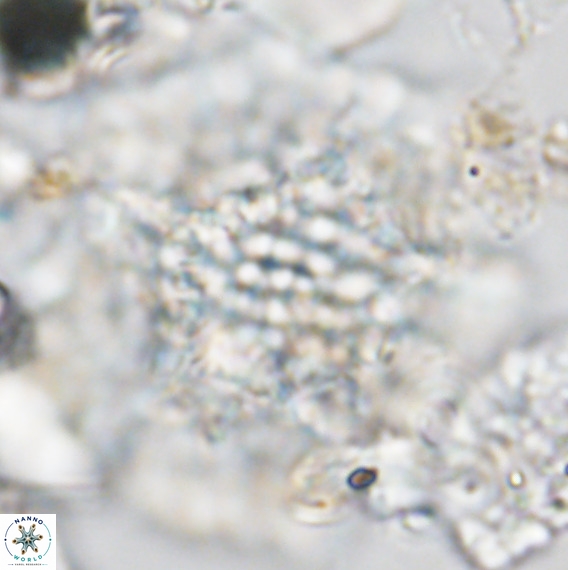 Calcidinellum operosum VR 06092