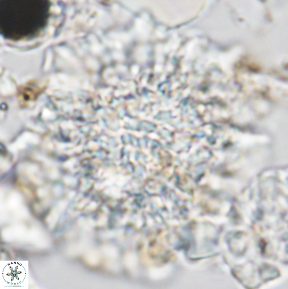 Calcidinellum operosum VR 06093