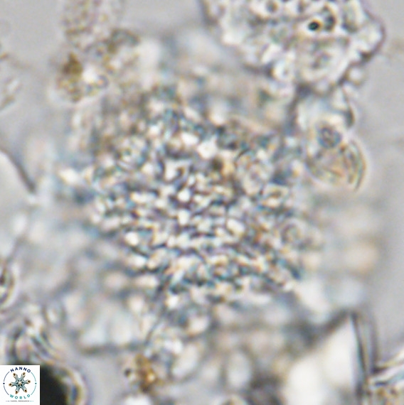 Calcidinellum operosum VR 06101