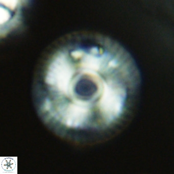 Calcidiscus tanianus VR 09657