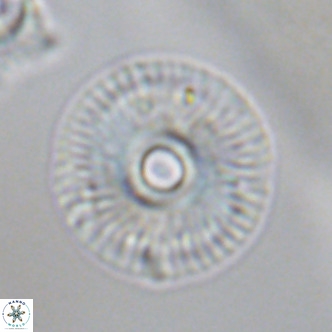 Calcidiscus tanianus VR 09659
