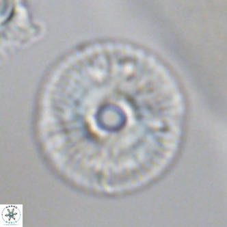 Calcidiscus tanianus VR 09661