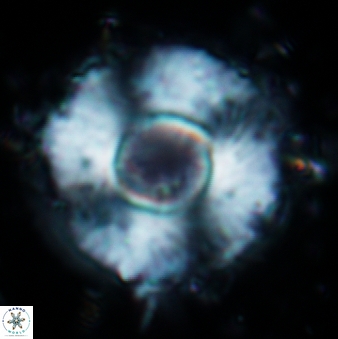 Calcidiscus tropicus 613