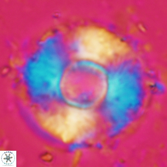 Calcidiscus tropicus 614