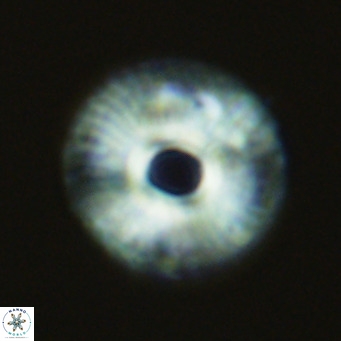 Calcidiscus tropicus VR 09916