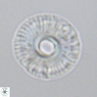 Calcidiscus tropicus VR 09919