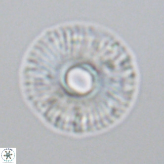 Calcidiscus tropicus VR 09920