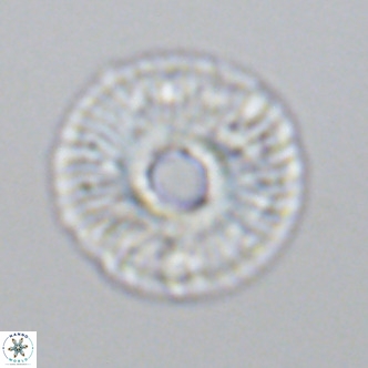 Calcidiscus tropicus VR 09921